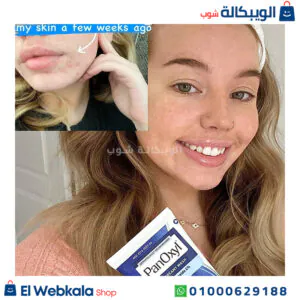 غسول PanOxyl لترطيب للبشرة - PanOxyl Acne Creamy Wash Benzoyl Peroxide 4% Daily Control غسول PanOxyl