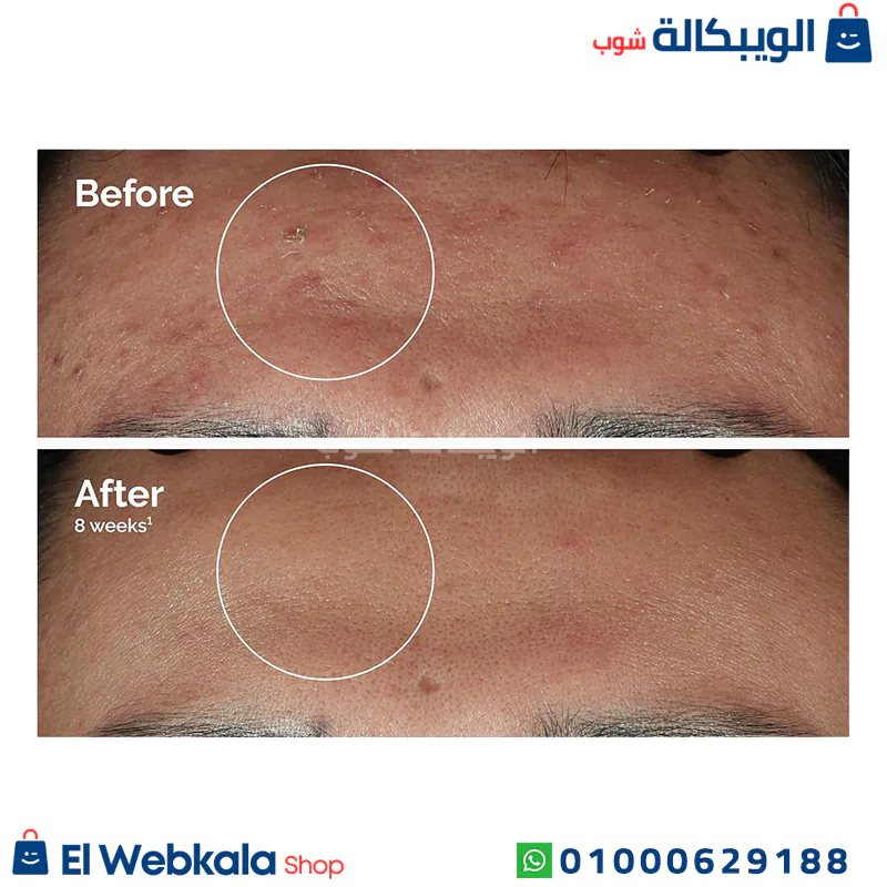 سيروم ذا اورديناري نياسيناميد