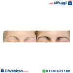 سيروم rapidlash