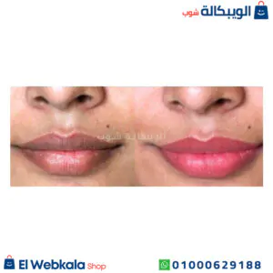فازلين وردي للشفايف للترطيب العميق - Vaseline lip therapy rosy lips فازلين وردي للشفايف