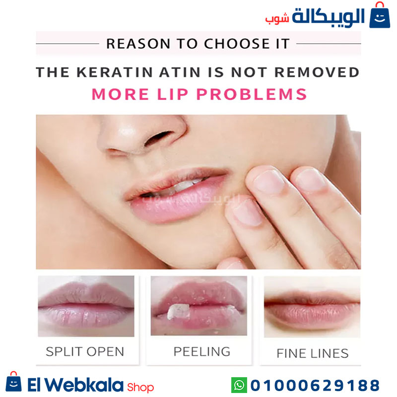 مرطب شفاه طبي استيلين