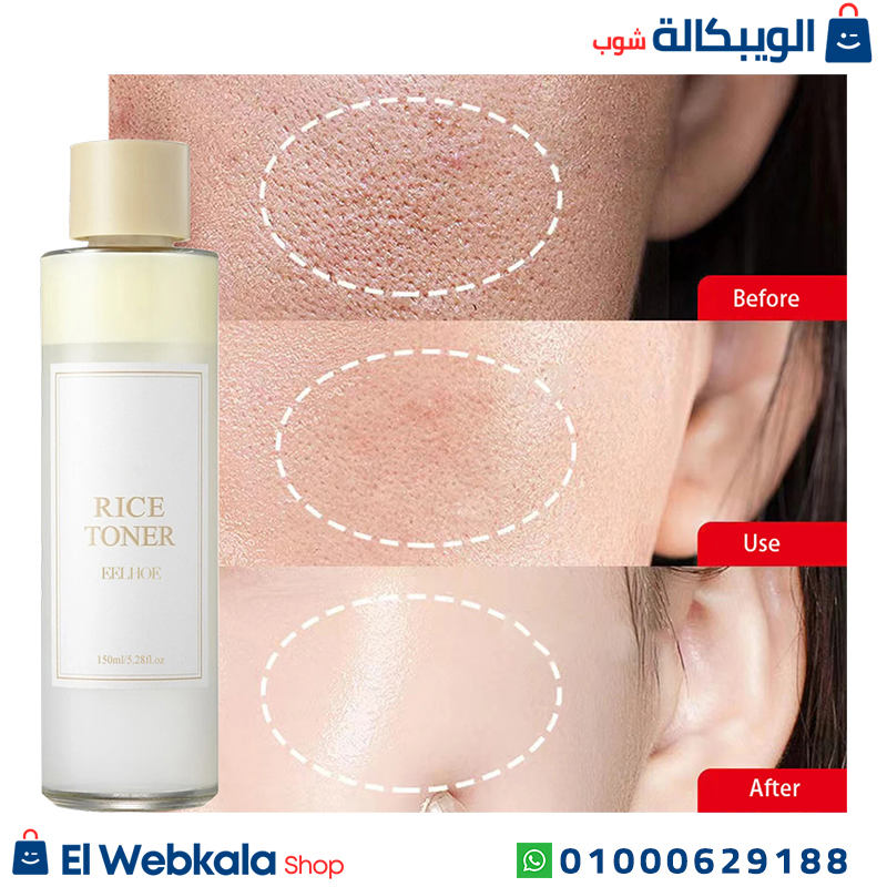 تونر الارز