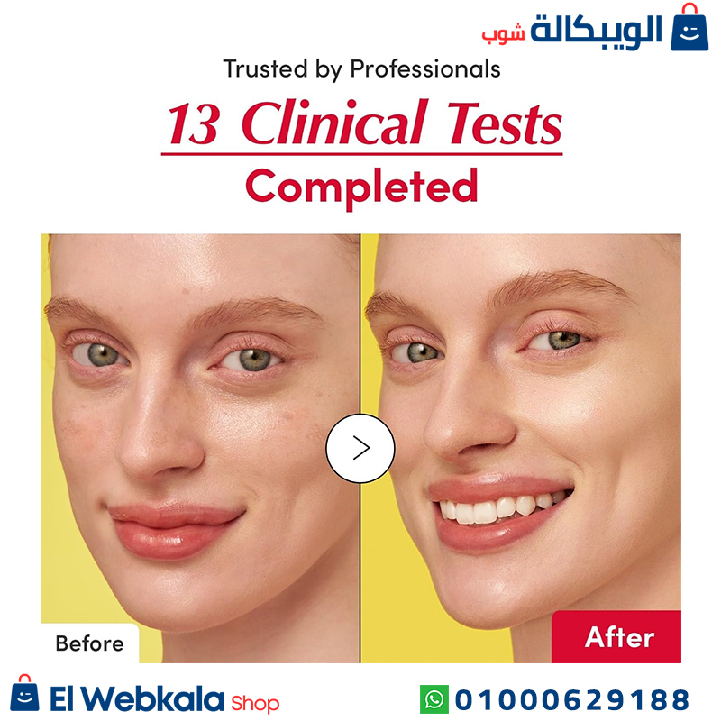 سيروم ايكول بيري الاصفر